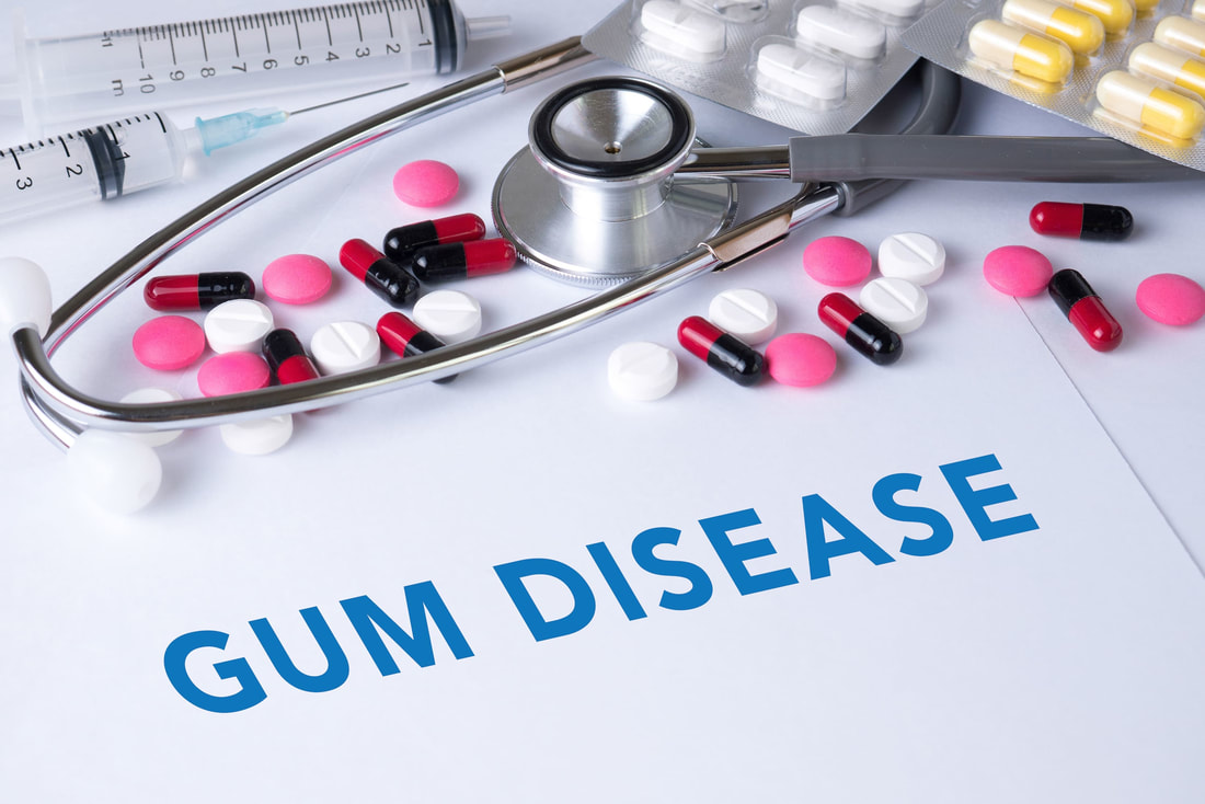 Gum Disease Treatments Available